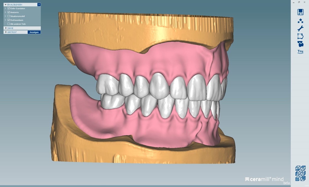 CERAMILL D-FLOW DENTURE SOFTWARE