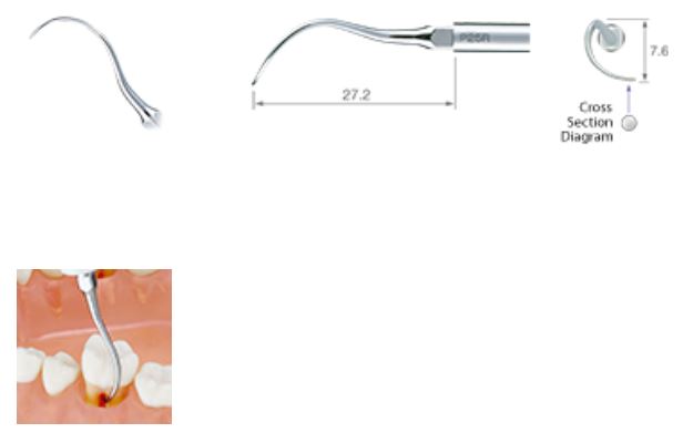NSK ULTRASONIC PERIO TIP P25R-E FOR EMS