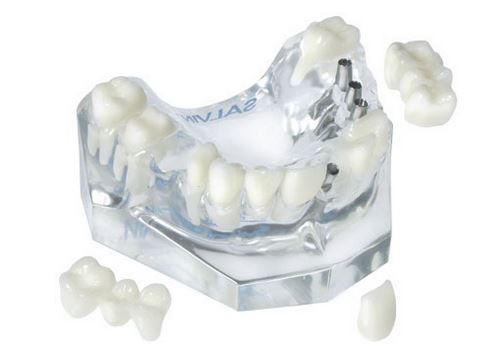 DEMOMODEL 3 IMP/SINGLE & IMPL/NAT BRIDGE