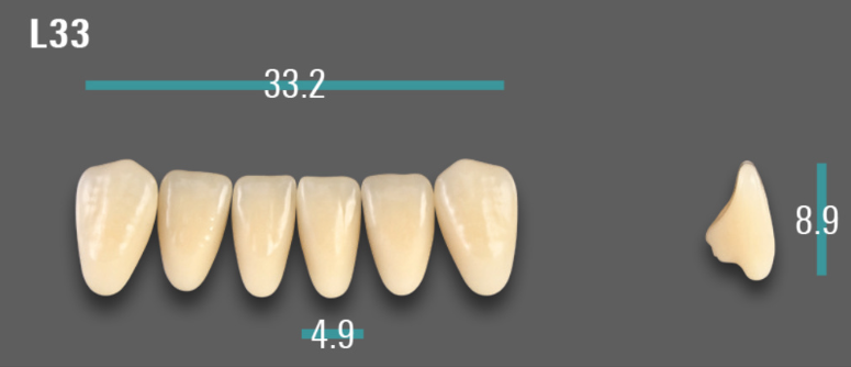VITA VIONIC VIGO Anterior, 0M1, L33