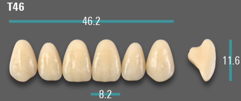 VITA VIONIC VIGO Anterior, 0M1, T46
