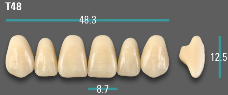 VITA VIONIC VIGO Anterior, 0M1, T48