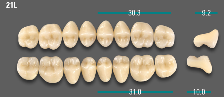 VITA VIONIC VIGO Posterior, A1, 21L OK