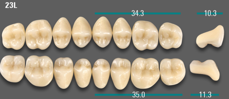 VITA VIONIC VIGO Posterior, A1, 23L UK