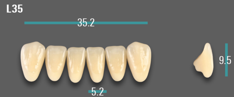 VITA VIONIC VIGO Anterior, A1, L35