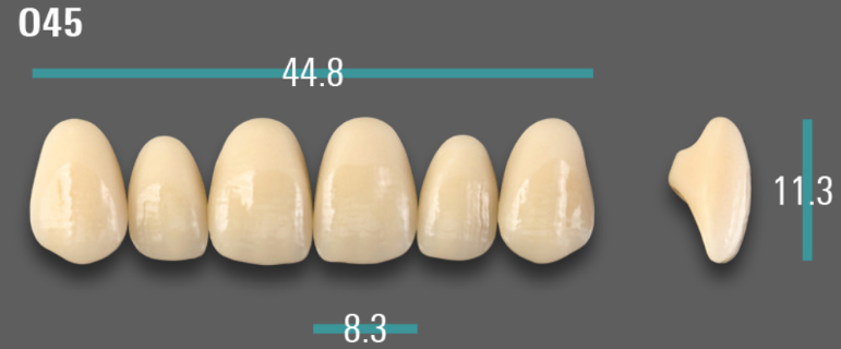 VITA VIONIC VIGO Anterior, A1, O45