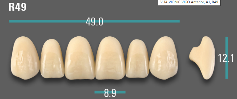 VITA VIONIC VIGO Anterior, A1, R49