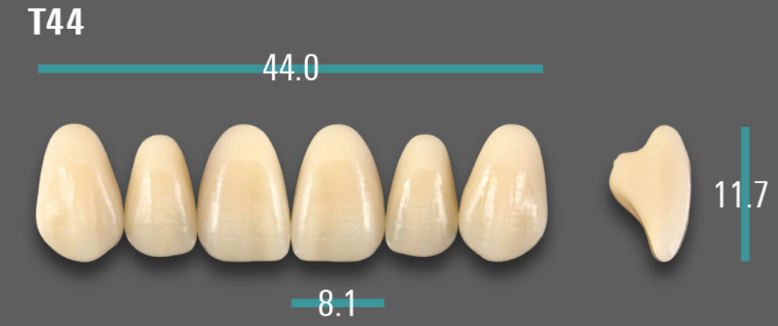 VITA VIONIC VIGO Anterior, A1, T44