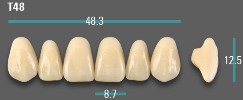 VITA VIONIC VIGO Anterior, A1, T48