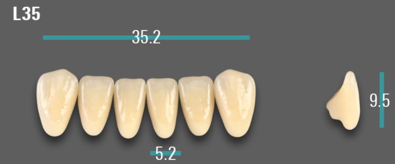 VITA VIONIC VIGO Anterior, A2, L35
