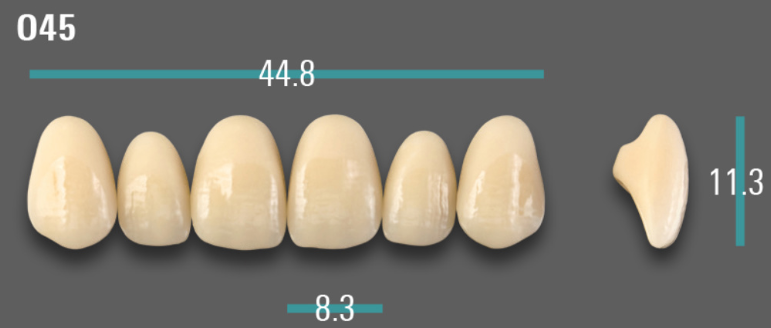 VITA VIONIC VIGO Anterior, A2, O45