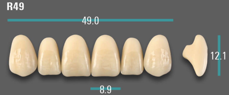 VITA VIONIC VIGO Anterior, A2, R49