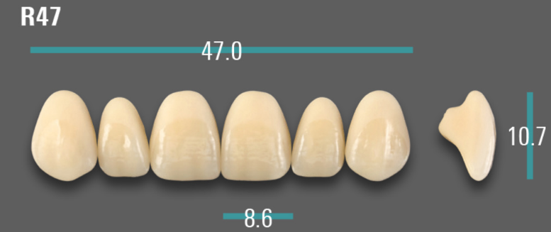 VITA VIONIC VIGO Anterior, A3.5, R47