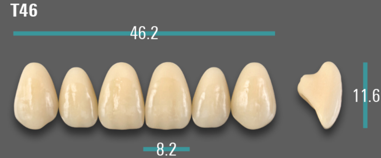 VITA VIONIC VIGO Anterior, A3.5, T46