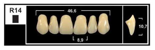 [GBR14-BL3] R14 BL3 UPPER ANTERIOR TRIBOS TEETH