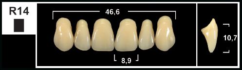 [GBR14-C1U] R14 C1 UPPER ANTERIOR TRIBOS TEETH