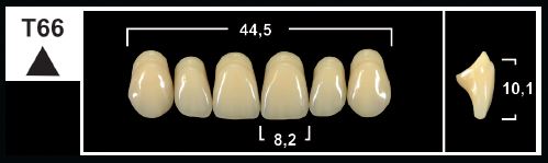 [GBT66-D3U] T66 D3 UPPER ANTERIOR TRIBOS TEETH