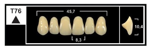 [GBT76-BL3] T76 BL3 UPPER ANTERIOR TRIBOS TEETH