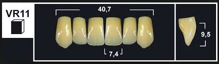 [GBVR11-A2U] VR11 A2 UPPER ANTERIOR TRIBOS TEETH