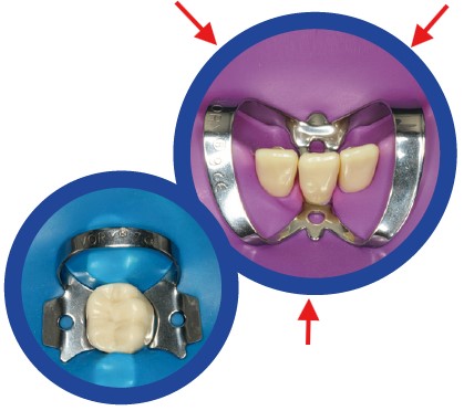 [IV66094060] IVORY RUBBER DAM LATEX FREE PURPLE 5X5 PKT 15