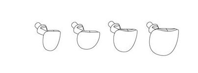 [LM7600] MULTIHOLDER CERVICAL MATRICES ASST /120