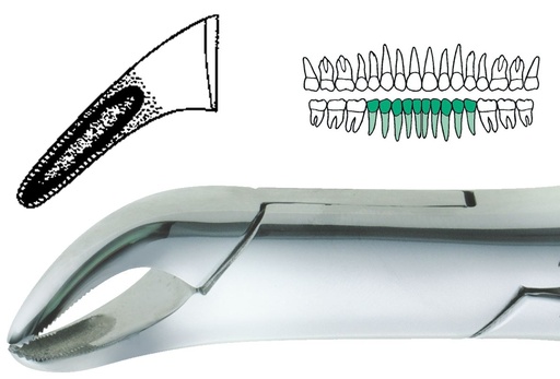 [SADEF151TC] EXTRACTION FORCEPS TC 151