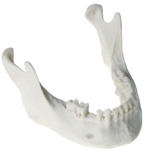 [SAMANDPERIOD] PERIO DEFECT MODEL