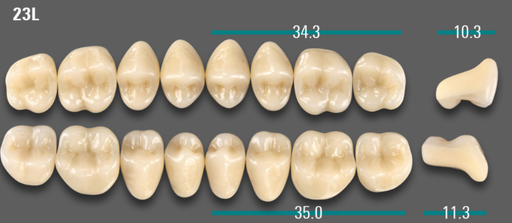 [VIAB0M1V23LUK] VITA VIONIC VIGO Posterior, 0M1, 23L UK