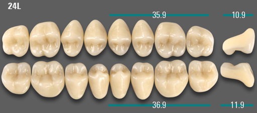 [VIAB0M1V24LOK] VITA VIONIC VIGO Posterior, 0M1, 24L OK