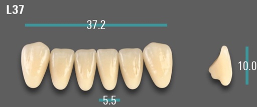 [VIAB0M1VL37] VITA VIONIC VIGO Anterior, 0M1, L37