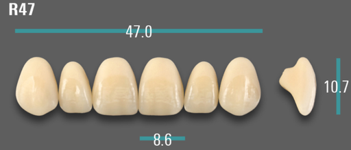 [VIAB0M1VR47] VITA VIONIC VIGO Anterior, 0M1, R47