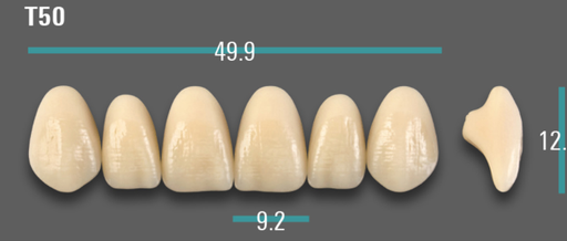 [VIAB0M1VT50] VITA VIONIC VIGO Anterior, 0M1, T50
