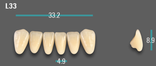 [VIABA1VL33] VITA VIONIC VIGO Anterior, A1, L33