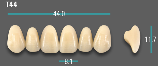 [VIABA1VT44] VITA VIONIC VIGO Anterior, A1, T44