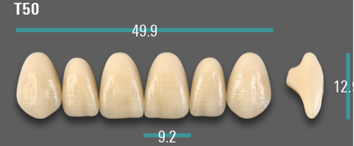 [VIABA1VT50] VITA VIONIC VIGO Anterior, A1, T50
