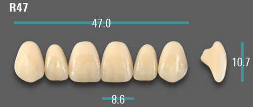 [VIABA2VR47] VITA VIONIC VIGO Anterior, A2, R47