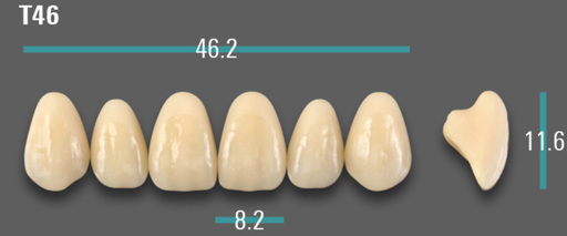 [VIABA2VT46] VITA VIONIC VIGO Anterior, A2, T46