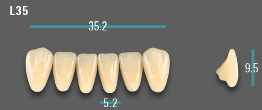 [VIABA35VL35] VITA VIONIC VIGO Anterior, A3.5, L35