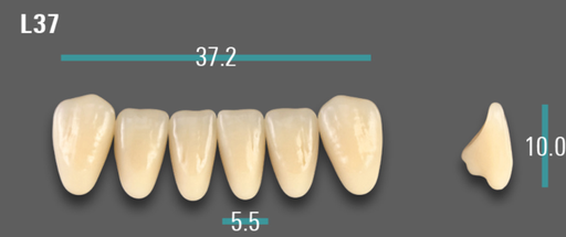 [VIABA35VL37] VITA VIONIC VIGO Anterior, A3.5, L37