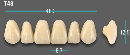[VIABA3VT48] VITA VIONIC VIGO Anterior, A3, T48