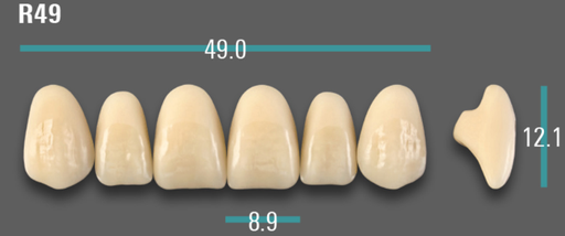 [VIABB3VR49] VITA VIONIC VIGO Anterior, B3, R49