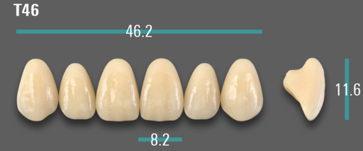 [VIABD3VT46] VITA VIONIC VIGO Anterior, D3, T46